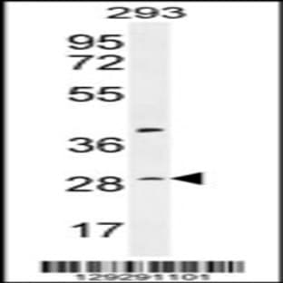 anti-Chromosome 19 Open Reading Frame 38 (C19ORF38) (AA 129-158), (Center) antibody avatar