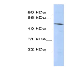 anti-B-Cell CLL/lymphoma 6, Member B (BCL6B) (Middle Region) antibody avatar