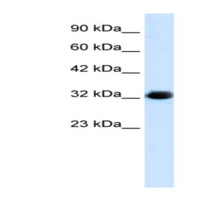 anti-Chromosome 22 Open Reading Frame 31 (C22orf31) (Middle Region) antibody avatar