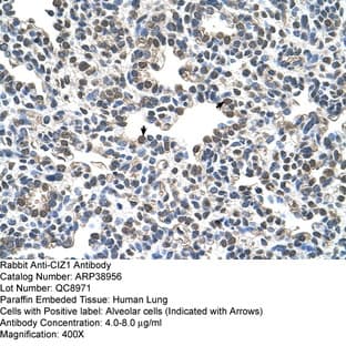 anti-CDKN1A Interacting Zinc Finger Protein 1 (CIZ1) (C-Term) antibody avatar