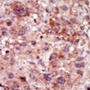 anti-Cyclin G Associated Kinase (GAK) (N-Term) antibody avatar