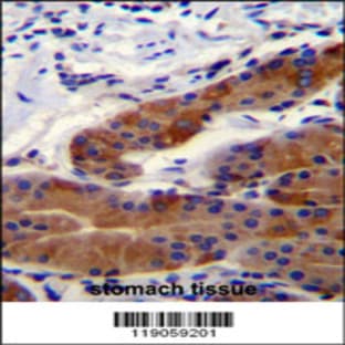 anti-Deafness, Autosomal Recessive 31 (DFNB31) (AA 378-406), (Center) antibody avatar