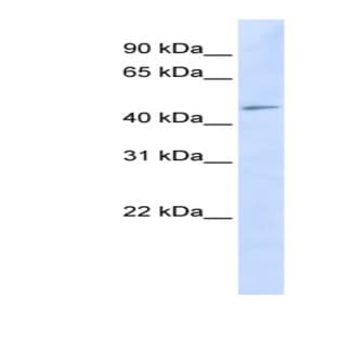 anti-Chromosome 3 Open Reading Frame 17 (C3orf17) (Middle Region) antibody avatar