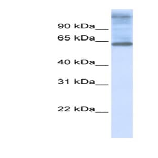 anti-Chromosome 3 Open Reading Frame 17 (C3orf17) (Middle Region) antibody avatar