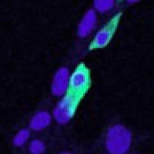 anti-Chloride Intracellular Channel 4 (CLIC4) (N-Term) antibody avatar