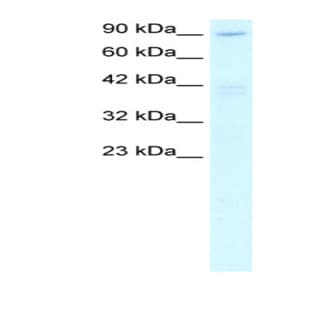 anti-Chromosome 20 Open Reading Frame 194 (C20orf194) (C-Term) antibody avatar