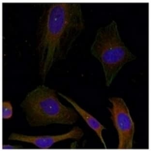 anti-Growth Associated Protein 43 (GAP43) (Ser41) antibody avatar