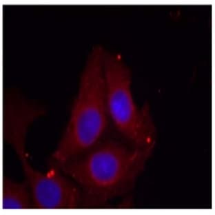 anti-Growth Associated Protein 43 (GAP43) (pSer41) antibody avatar