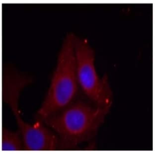anti-Growth Associated Protein 43 (GAP43) (pSer41) antibody avatar