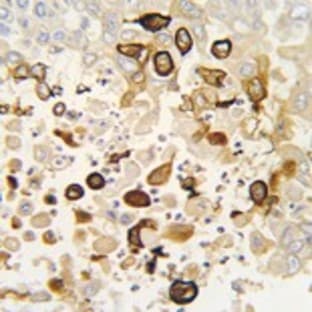 anti-Cytochrome P450, Family 4, Subfamily X, Polypeptide 1 (CYP4X1) (N-Term) antibody avatar