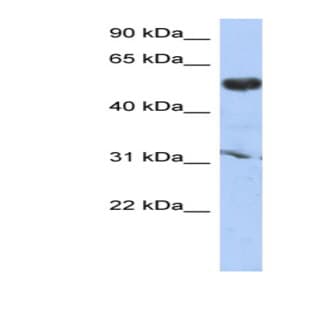 anti-Cytochrome P450, Family 4, Subfamily X, Polypeptide 1 (CYP4X1) (Middle Region) antibody avatar