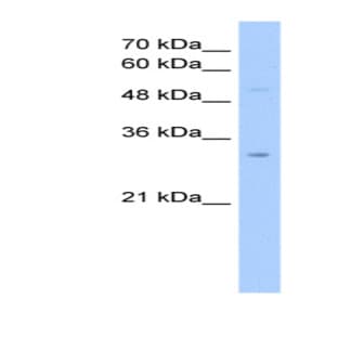 anti-NOP2/Sun Domain Family, Member 5 Pseudogene 2 (NSUN5P2) (Middle Region) antibody avatar