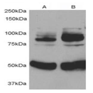 anti-Adaptor Protein, phosphotyrosine Interaction, PH Domain and Leucine Zipper Containing 1 (APPL1) (Internal Region) antibody avatar