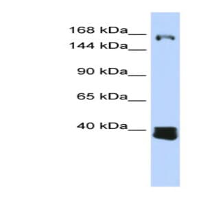 anti-Chromosome 10 Open Reading Frame 12 (C10orf12) (Middle Region) antibody avatar