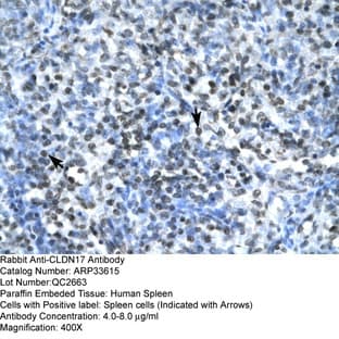 anti-Claudin 17 (CLDN17) (Middle Region) antibody avatar