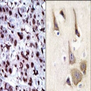 anti-Adenylate Kinase 5 (AK5) (N-Term) antibody avatar