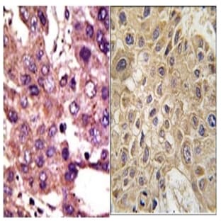 anti-Autocrine Motility Factor Receptor (AMFR) (N-Term) antibody avatar