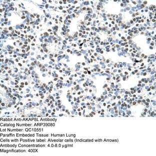 anti-A Kinase (PRKA) Anchor Protein 8-Like (AKAP8L) (C-Term) antibody avatar