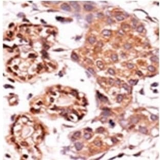 anti-ABL2 (Middle Region) antibody avatar