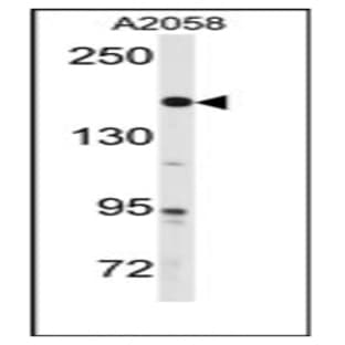 anti-ABL2 (Center) antibody avatar