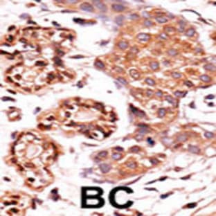 anti-ABL2 (Center) antibody avatar