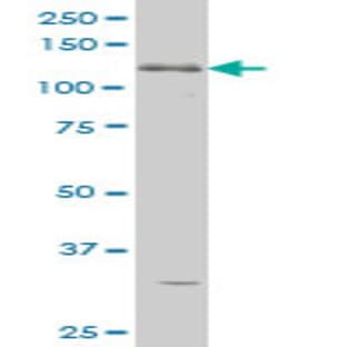 anti-ABL2 (AA 743-842) antibody avatar