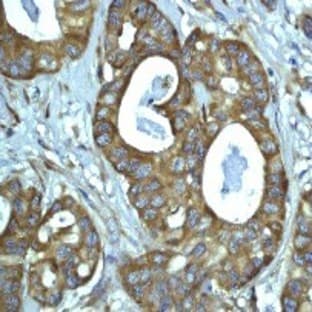 anti-BCL2 Binding Component 3 (BBC3) (C-Term) antibody