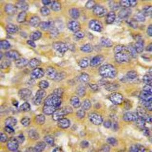 anti-DKK3 (N-Term) antibody