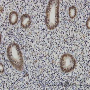 anti-AF4/FMR2 Family, Member 4 (AFF4) (AA 1-109) antibody avatar