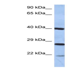 anti-Cell Death-Inducing DFFA-Like Effector B (CIDEB) (Middle Region) antibody avatar
