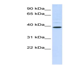 anti-Chitinase, Acidic (CHIA) (Middle Region) antibody avatar