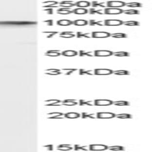 anti-Disrupted in Schizophrenia 1 (DISC1) (Internal Region) antibody