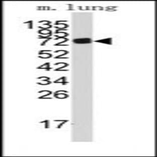 anti-Adenosine Monophosphate Deaminase 3 (AMPD3) (Middle Region) antibody avatar