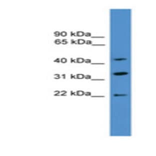 anti-ADP-Ribosylation Factor Interacting Protein 1 (ARFIP1) (C-Term) antibody avatar