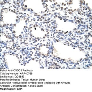 anti-Cold Shock Domain Containing C2, RNA Binding (CSDC2) (N-Term) antibody avatar