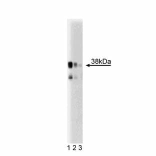 anti-Serine Racemase (SRR) (AA 127-248) antibody avatar