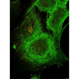 anti-GLI Family Zinc Finger 3 (GLI3) (AA 41-57) antibody avatar