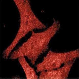 anti-Casein Kinase 1, epsilon (CSNK1E) (AA 248-414) antibody avatar