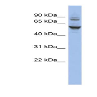 anti-Cat Eye Syndrome Chromosome Region, Candidate 6 (CECR6) (N-Term) antibody avatar