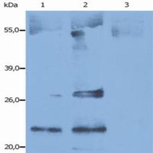 anti-CD9 (CD9) antibody avatar