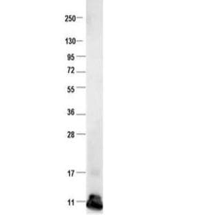 anti-Chemokine (C-C Motif) Ligand 2 (CCL2) antibody avatar