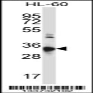 anti-Chemokine (C-C Motif) Receptor 10 (CCR10) (N-Term), (AA 1-30) antibody avatar