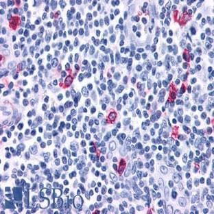 anti-Chemokine (C-X-C Motif) Receptor 3 (CXCR3) (C-Term) antibody avatar