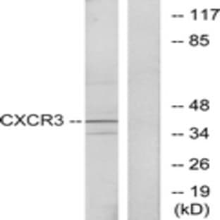 anti-Chemokine (C-X-C Motif) Receptor 3 (CXCR3) antibody avatar