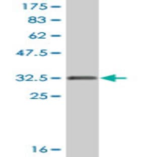 anti-Chemokine (C-X-C Motif) Receptor 3 (CXCR3) (AA 1-53) antibody avatar