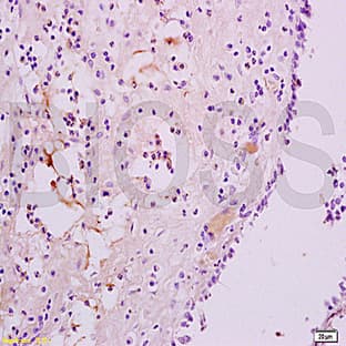 anti-Chemokine (C-X-C Motif) Receptor 3 (CXCR3) antibody avatar