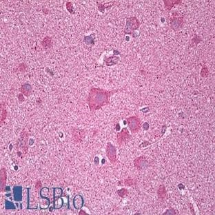 anti-Chemokine (C-X-C Motif) Receptor 3 (CXCR3) (AA 161-210) antibody avatar