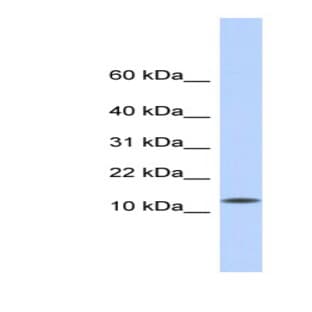 anti-CMT1A Duplicated Region Transcript 4 (CDRT4) (Middle Region) antibody avatar