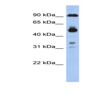 anti-Coiled-Coil Domain Containing 144B (Pseudogene) (CCDC144B) (Middle Region) antibody avatar