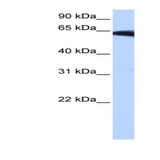 anti-Phosphatidylinositol Glycan W (PIGW) (Middle Region) antibody avatar